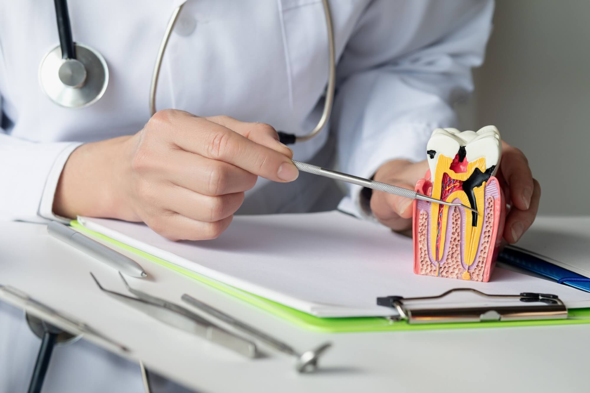 The dentist shows the disease and the formation of the tooth pulp