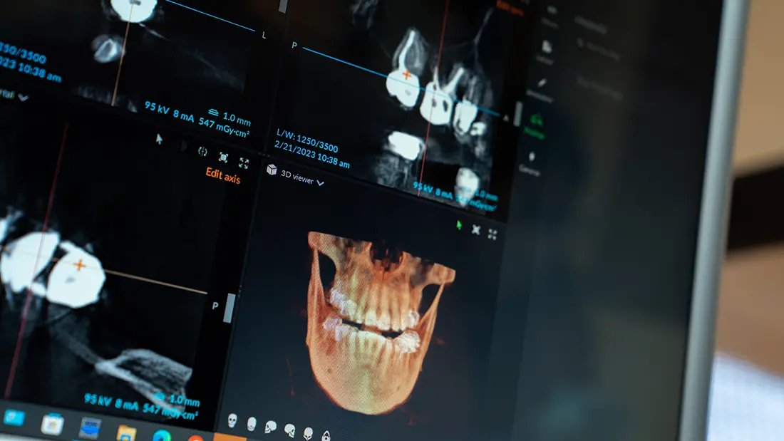 Human jaw X-ray