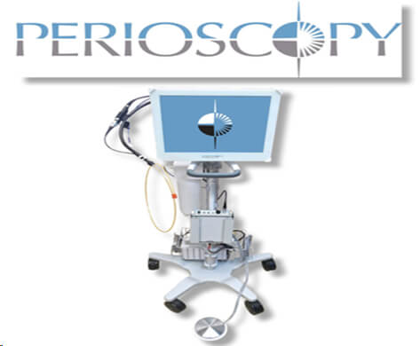 Perioscopy Logo