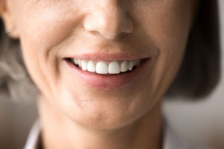 beautiful older woman smile after whitening procedure,