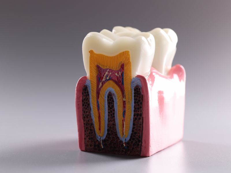 Educational model of tooth
