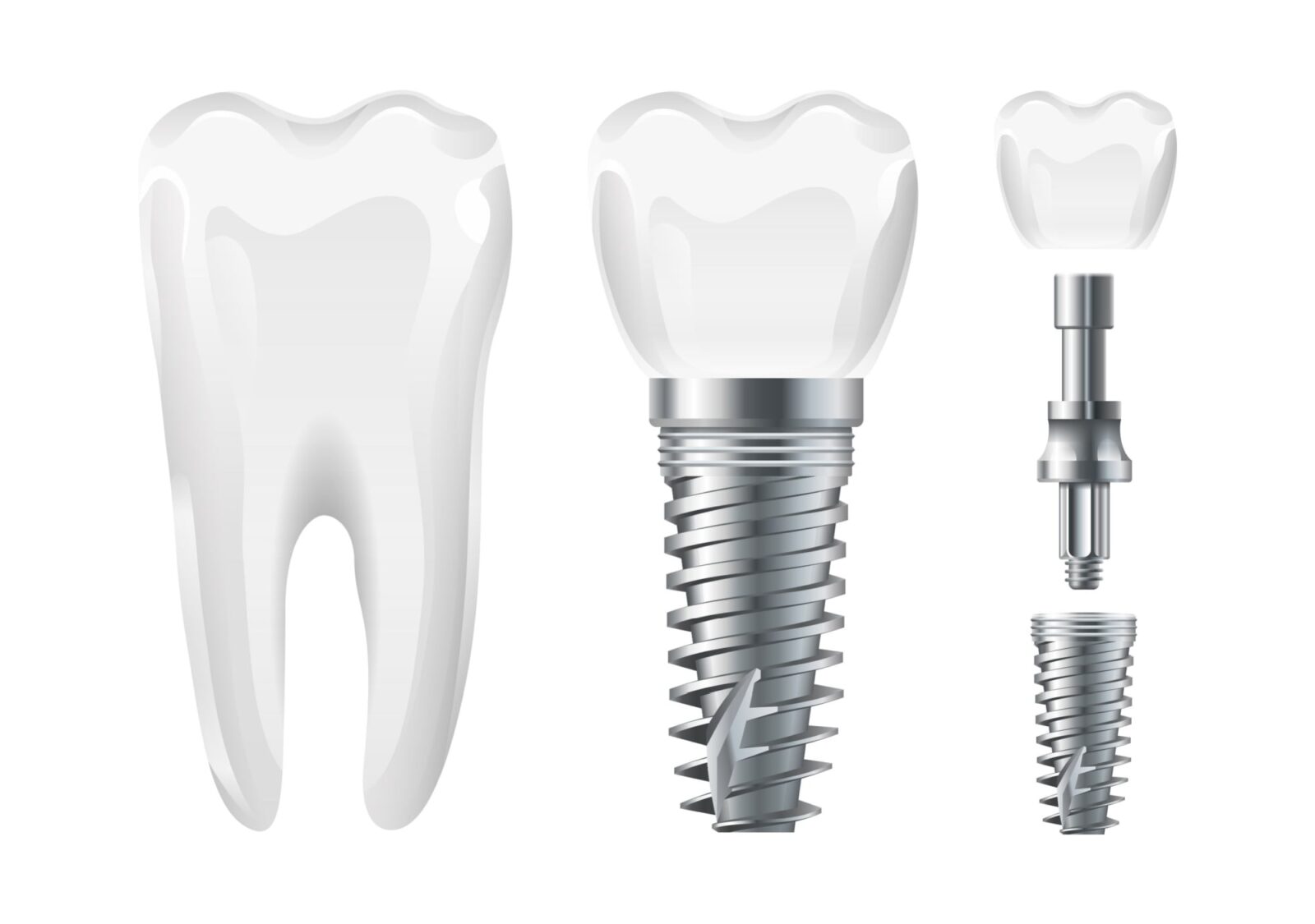 Implant cut and healthy tooth