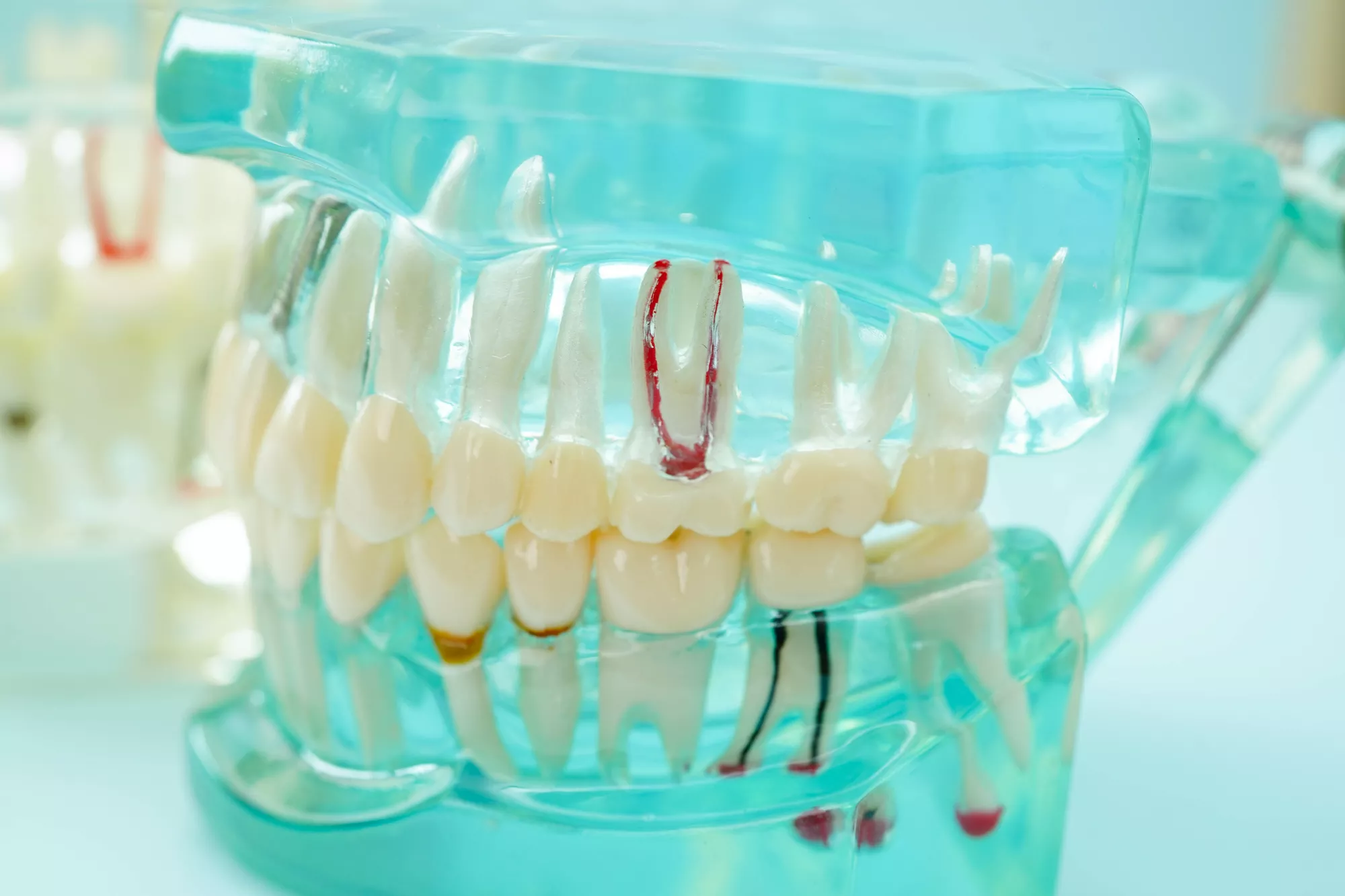 Apico Dental Surgery