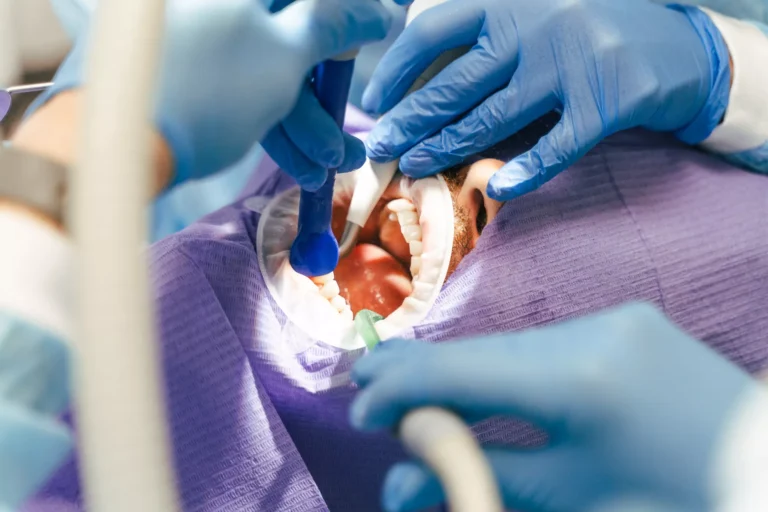 wisdom-tooth-extraction-in-pasadena Image description