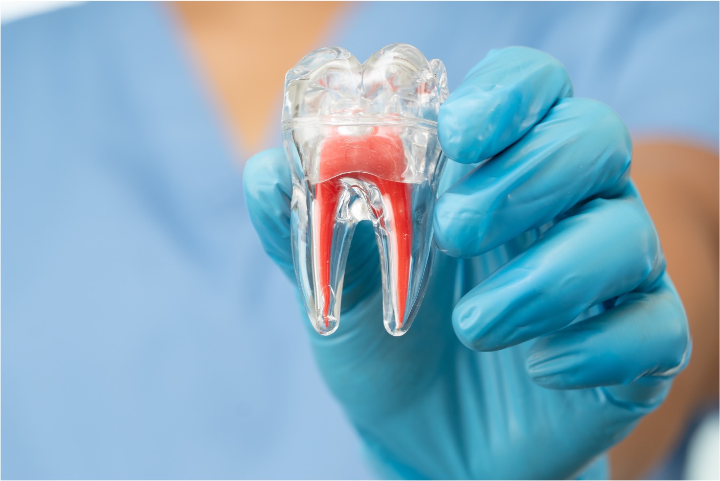 Widom Tooth Extraction Pasadena - Foundation Dental