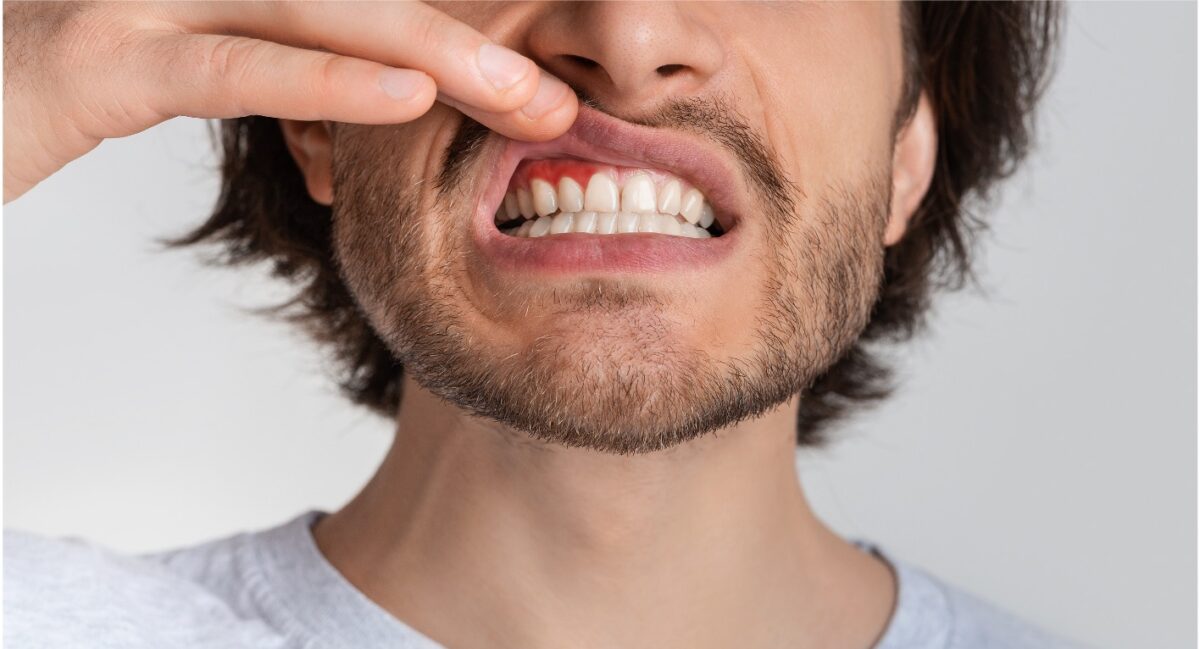 Periodontal Care
